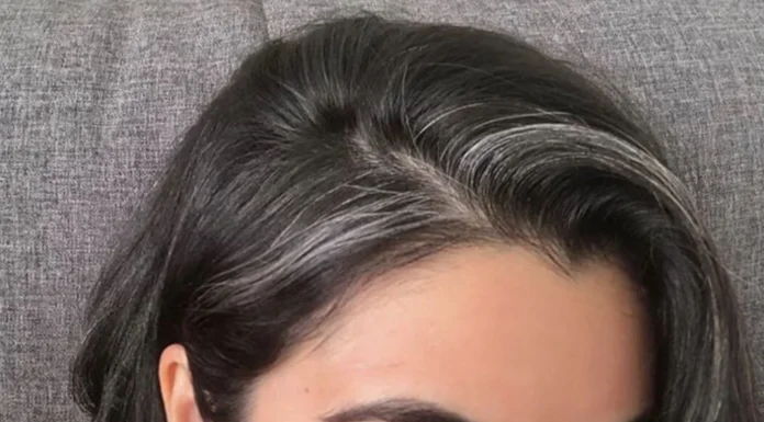 Cabelo branco aos 25: genética, estresse e hábitos aceleram