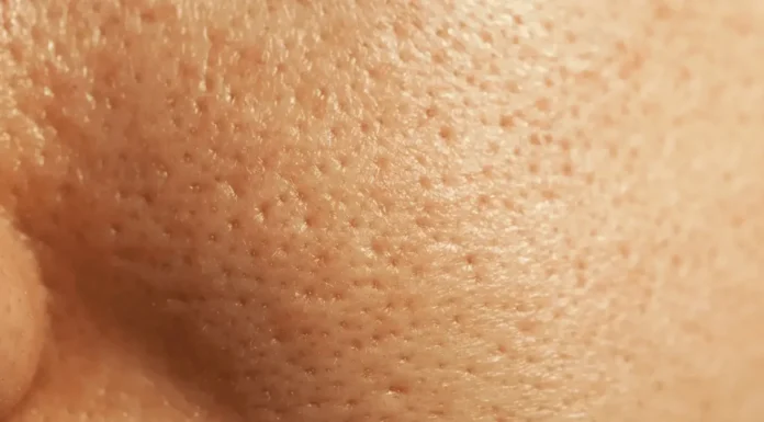 Poros dilatados: gel esfoliante da Nívea reduz em casa