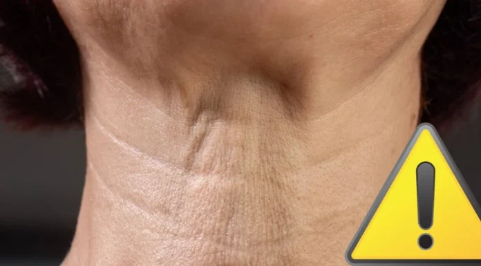 Rugas no pescoço: 5 dicas aprovadas por dermatologista